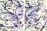 TWIGGY CAMO SUIT - Size 1